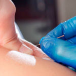 Formation Dry Needling - Prérequis