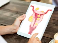 Prise en charge nutritionnelle du syndrome des ovaires polykystiques (SOPK)