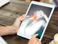 Inflammation : Prise en charge nutritionnelle et micronutritionnelle